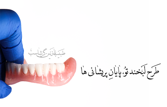 دندان مصنوعی کامل چیست