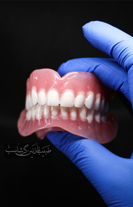 قیمت دندان مصنوعی کامل سال 1401 تهران
